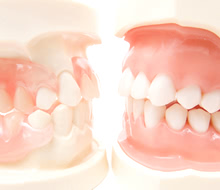 天然歯とインプラントの違いも重要