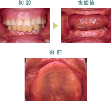 症例