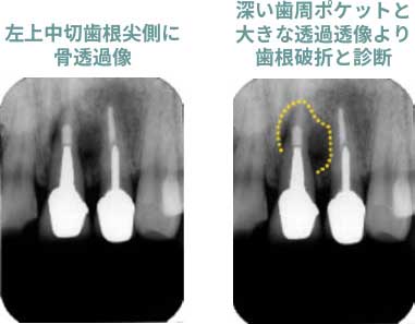 デンタルX線診査