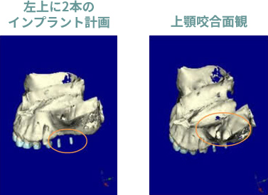 症例