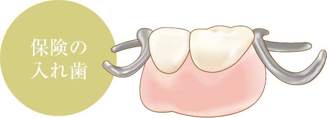 保険の入れ歯