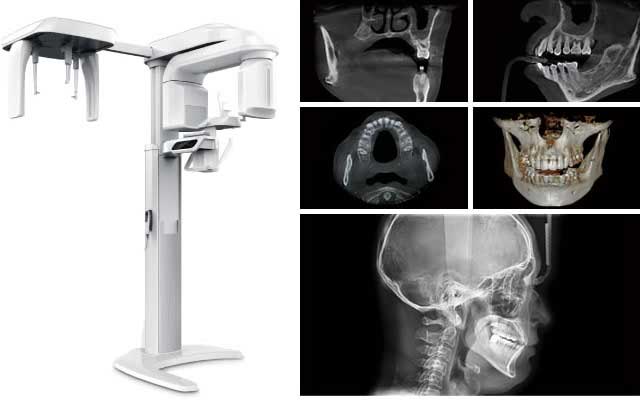 歯科用CTにより細部が正確に把握でき、的確な診断が行えるように