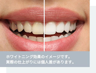 効果が持続しやすい